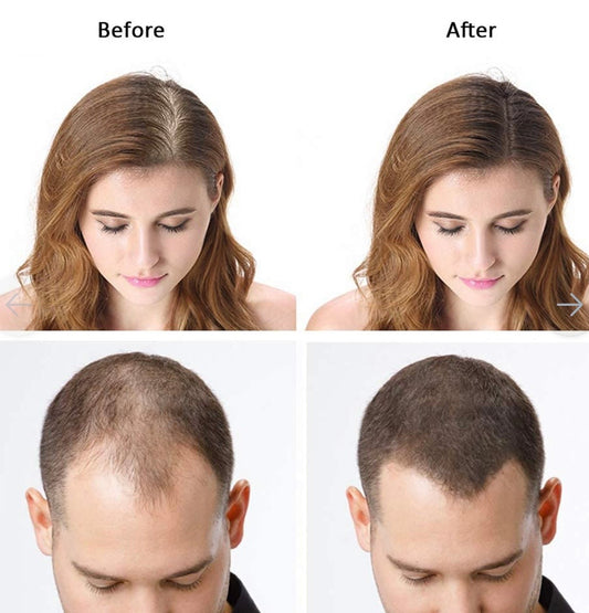Hair Building Fiber For Men & Women | Gurannted Results🔥